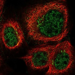 TTDN1 Antibody, Novus Biologicals:Antibodies:Primary Antibodies
